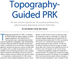 Topography-Guided PRK